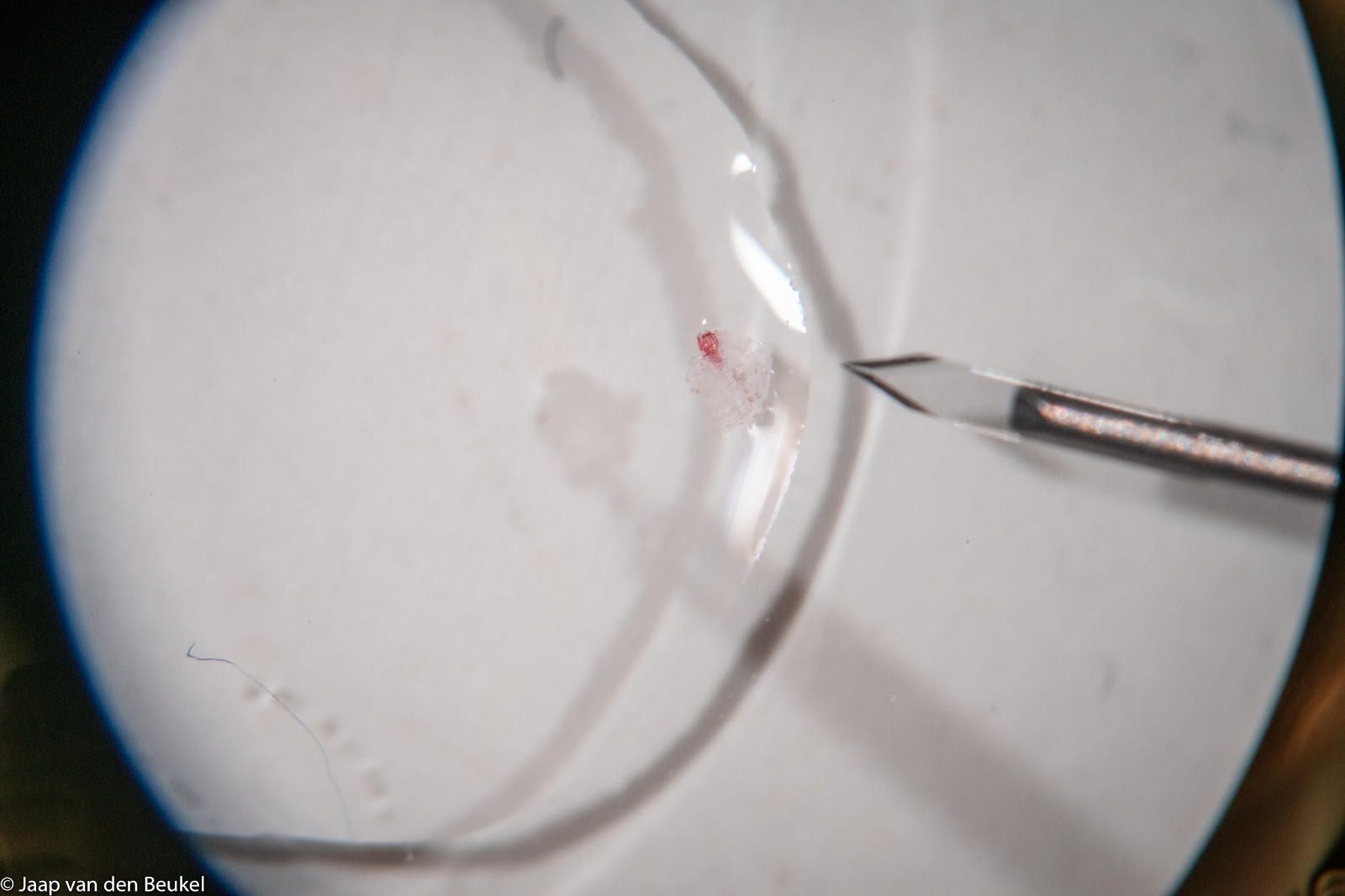 microdissecties
