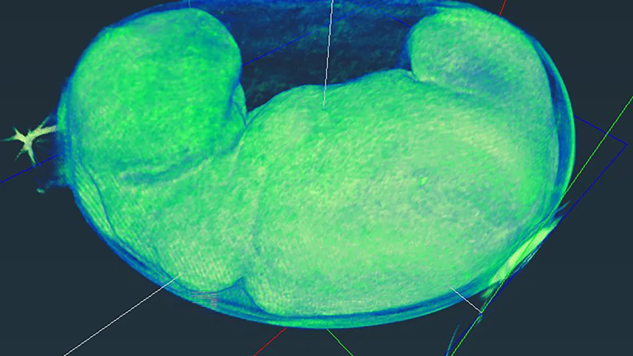 Triturus embryo