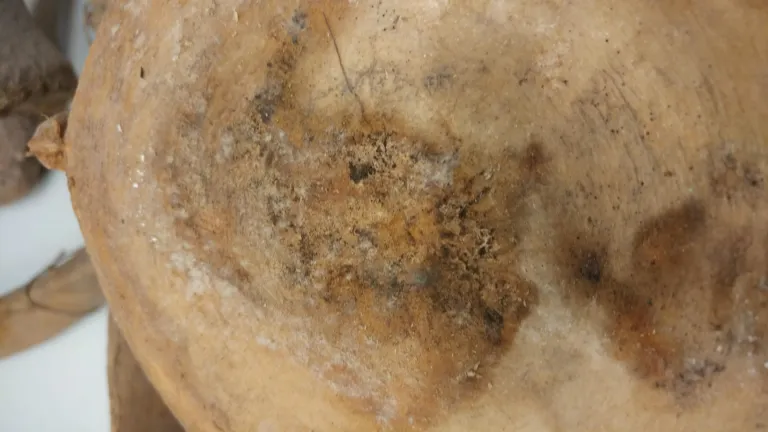 moldy bone