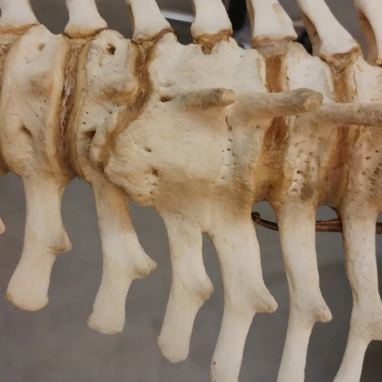 Fused vertebrae