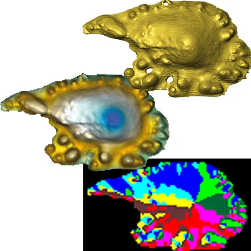 Acanthodian