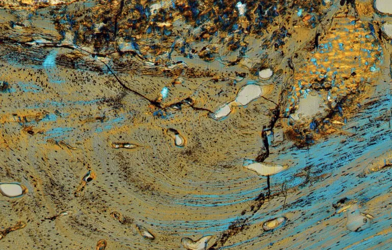 A thin-sectioned dermal plate of a placoderm from the Lower Devonian of China